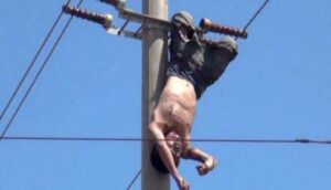 قصة مؤلمة لشاب قُطِعت يداه في محاولة انتحار فاشلة