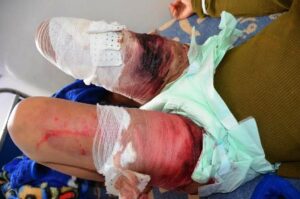 أربعة "محاضرية" أمام غرفة الجنايات بأكادير، و"سميرة"ضحية الكي والجلد توارى الثرى 3 a 210