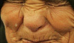 صادم:مسنة في أرذل العمر تتعرض لاغتصاب وحشي 1 femme viol