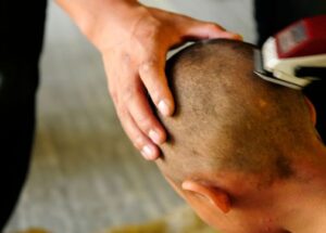 "شيخ"يعنف زوجته و يحلق رأسها بالكامل، ثم يرسلها إلى مستشفى الحسن الثاني 9 a 86