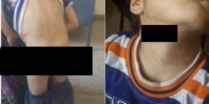 معطيات جديدة في قضية الراقصة التي عذبت طفل جارتها وعمدت إلى كيه في وجهه ومؤخرته 3 1462200037 3620f1f81afda6cf3814544ff2a951023560.jpeg