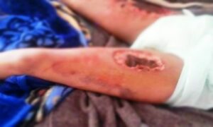 (+فيديو)هذا ما قررته ابتدائية تيزنيت في حق العمة التي حولت جسد ابنة أخيها إلى “مزرعة للتعذيب”