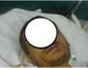 بالصورة:نقل عون سلطة الى مستعجلات تارودانت نطحه رئيس جماعة برأسية 11 tn
