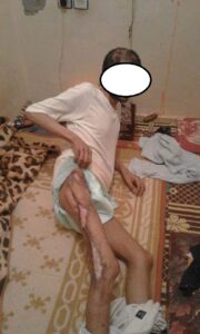 رشيد… قصة مؤثرة لشاب من ايت ملول  حوَّل” الفقْر” رجله إلى عمود من العضام