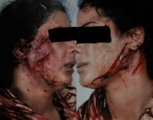 خطير: زوج يشرمل زوجته و يفر هاربا تاركا الضحية مغمى عليها وسط الدماء (+صورة)