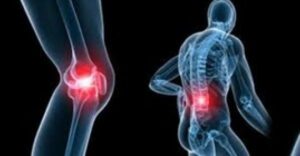 -وصفة سحرية ومجربة تخلصك من آلام المفاصل والعظام نهائيا.