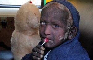 مرض معدي يثير الرعب في صفوف التلاميذ والآباء ويتسبب في إغلاق ثانوية