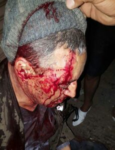 صور صادمة :حمى “الكريساج”بالسكاكين  تعود من جديد الى القليعة