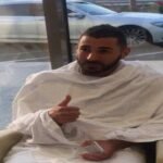 نصائح عملية لعلاج حروق الزيت والتصرف الصحيح حال تعرضك له