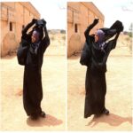 نصائح عملية لعلاج حروق الزيت والتصرف الصحيح حال تعرضك له