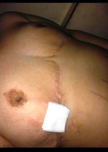 ضحايا التجميل بأكادير يشكون طبيبة للعدالة . 7 a 274