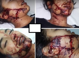 فيديو خطير : جزار بانزكان يقطع لسان فتاة بسكين ويحول وجهها إلى شوارع من الدماء 2 Capture 7