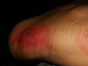 بالصور:ناموس غرييب يزعج ساكنة الدراركة ومطالب عاجلة بالتدخل