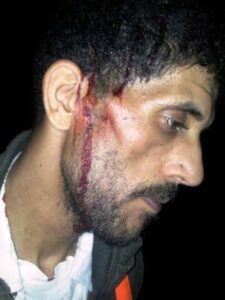 بلطجية يعتدون على حارس ليلي بأكادير