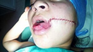 +صور حصرية: أكادير24 تنفرذ بنشر تفاصيل مجزرة عامل بمجزرة الذي كاد يقطع لسان فتاة قاصر