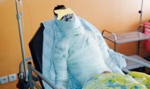 حريق مهول يرسل طفلين في حالة خطيرة إلى قسم المستعجلات بمستشفى الحسن الثاني بأكادير.