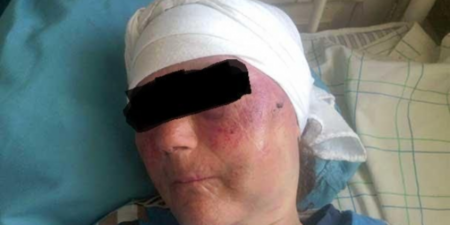 مسخوط ضرب أمه المسنة رفقة زوجته بسبب بكاء طفلهما الذي ترعاه المسنة مسخوط ضرب أمه المسنة رفقة زوجته بسبب بكاء طفلهما الذي ترعاه المسنة