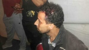 بالصور:التراشق بالحجارة بين منظمي مهرجان “تداكت وورغ” بتيزنيت وبين معارضيه،أسفر عن إصابة فكاهي أمازيغي و صحفي بجروح غائرة