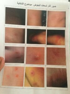 أكاديـر: حشرات سامة بالدراركـة تنذر بوباء خطير لا دواء له…