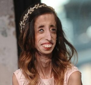 هكذا ردت أقبح امرأة فالعالم على الوثائقي الذي تطرق لحياتها وسخر منها