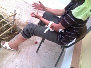 تلميذان يلقنان مدير إعدادية “علقة” ساخنة والأساتذة ينقلونه للمستشفى