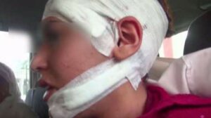 خطير بإنزكان: زوج يشرمل زوجته بمنشار حديدي بأيت ملول