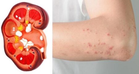 4 علامات تدل على أن كليتك في حالة خطيرة.. احذرها!