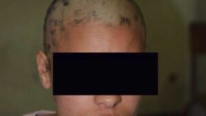 إذانة الطلبة المتهمين بحلق شعر النادلة شيماء