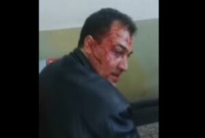 هذا ما يحدث عندما يتعارك شرطي الصقور مع أخطر مشرمل!!