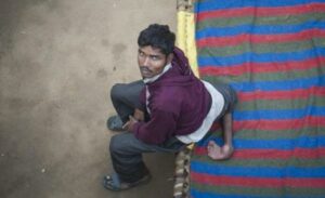 بالفيديو:شاب بأربع سيقان يبحث عن مساعدة طبية