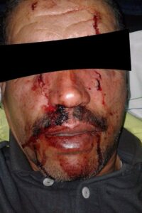 شركة ألزا سيتي أكادير توضح أحداث واقعة تغازوت