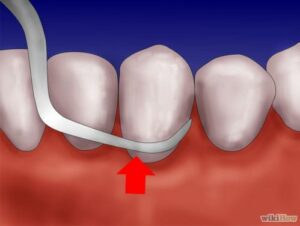 كيف ترتبط الأسنان بمشكلات ضعف الانتصاب