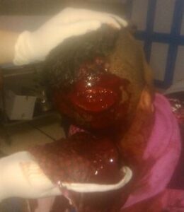 عااجل بأكادير:”بيتشو” يواصل اعتداءاته ويشرمل مؤخرة مواطن بأكادير