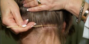 خطير : “القمل” يقتل سيدة وحفيدتها وهذه هي التفاصيل