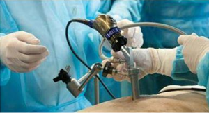 أول عملية جراحية بالمنظار بأولاد تايمة