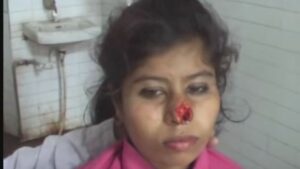 بالفيديو:يعض زوجته ويقطع أنفها لسبب غريب