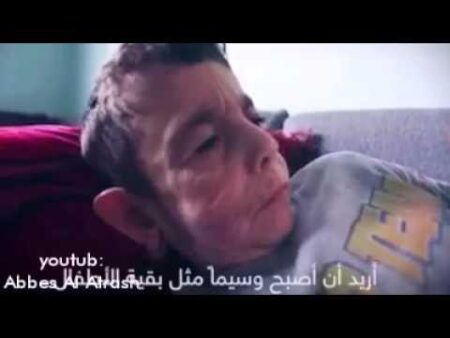 بالفيديو. الطفل العجوز الذي يريد أن يصبح وسيما مثل أقرانه