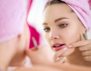 إحذري هذه المأكولات لانها تتُسبّب في ظهور البثور!!