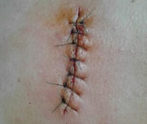 بالصور:”مول البيكالة” يظهر من جديد بالدشيرة ويصيب ظهر شابة بسيف كبير