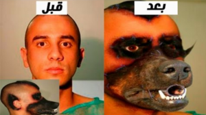 أغرب 5 أشخاص قاموا بعمليات غريبة جدا منهم إمرأة عربية