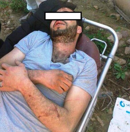 مواطن يتعرض "للكريساج" ضواحي قصبة الطاهر بأيت ملول