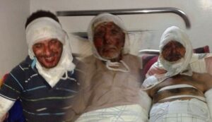 ضحايا حريق إفني يطالبون بمد يد المساعدة العاجلة