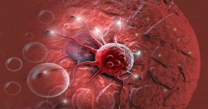 اكتشاف جديد يقضي على السرطان نهائيا