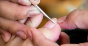 احترسى.. الباديكير فى مراكز التجميل يصيب السيدات بفيروس سى