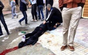 بالصور والفيديو:محاولة نشل هاتف تفضي لبتر ساق لص واعتقال شريكه