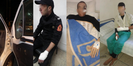+صور:إصابات خطيرة في صفوف رجال الأمن، وتخريب لسيارات الشرطة خلال أحداث الحسيمة +صور:إصابات خطيرة في صفوف رجال الأمن، وتخريب لسيارات الشرطة خلال أحداث الحسيمة