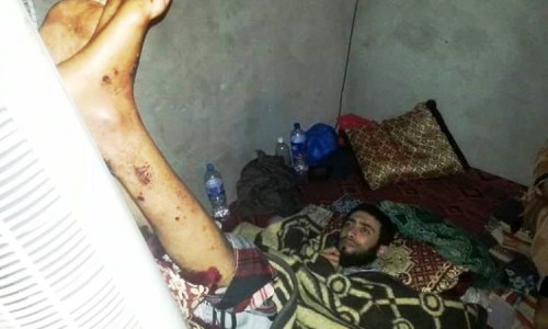 مأساة حقيقية بأكادير: مرض غريب يجبر شابا على رفع رجليه أمام “مبرد” ليل نهار.