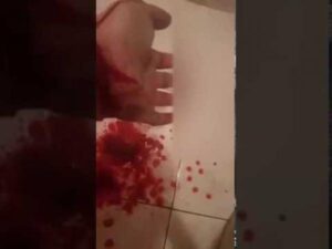 مفاجأة: افتضاح أمر مثلي جنسي حاول الانتحار ب”كيتشوب” بأكادير.