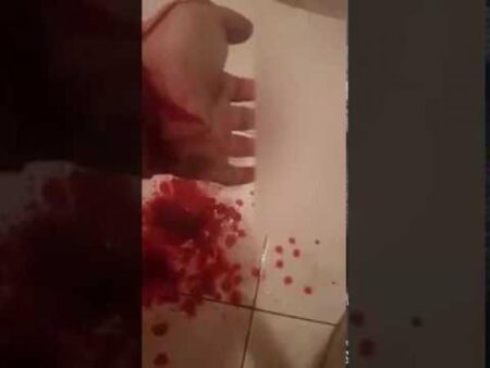 مفاجأة: افتضاح أمر مثلي جنسي حاول الانتحار ب"كيتشوب" بأكادير.