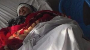 مواطن يقطع أذني زوجته ثم يلوذ بالفرار